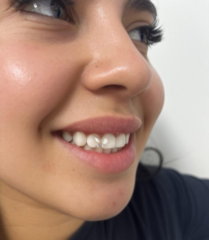 gema dental 1