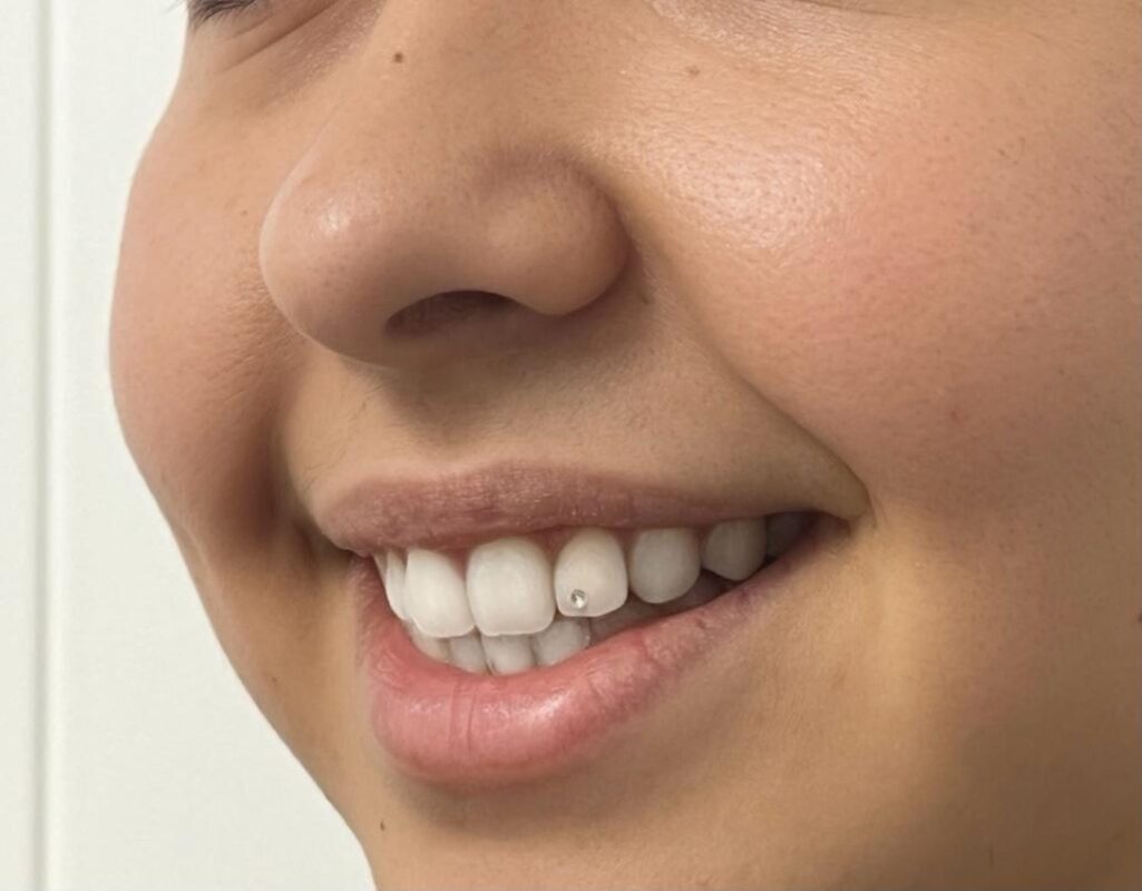 gema dental 3